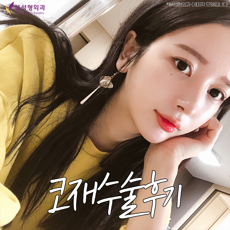 코재수술후기 꼼꼼하게 따져 보아야 할 점은 관련 이미지 7