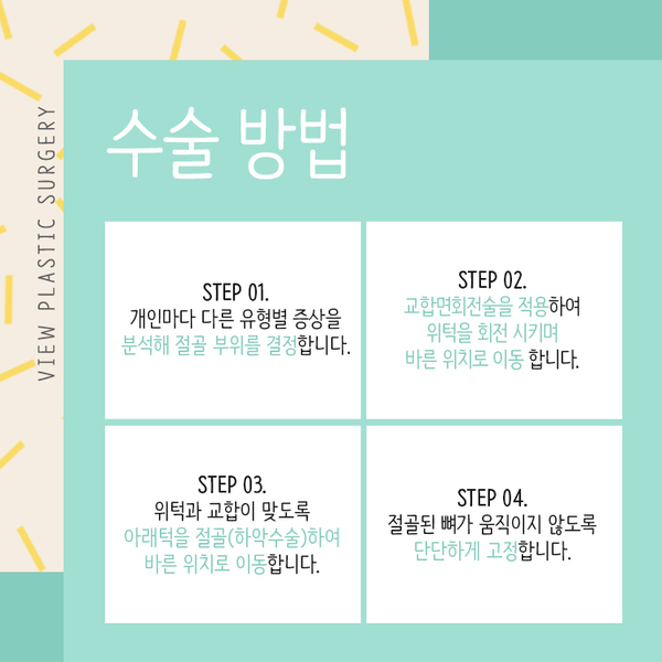 뷰 양악수술은 뭐가 다를까? 관련 이미지 3