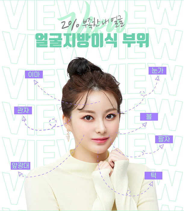 밋밋한 얼굴을 볼륨감 있게 입체적으로 개선하는 지방이식 관련 이미지 5