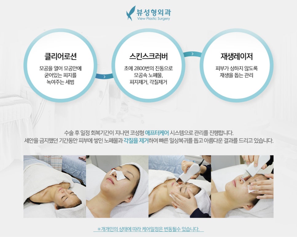 코수술비용 예산은 얼마나 잡아야 할까? 관련 이미지 11