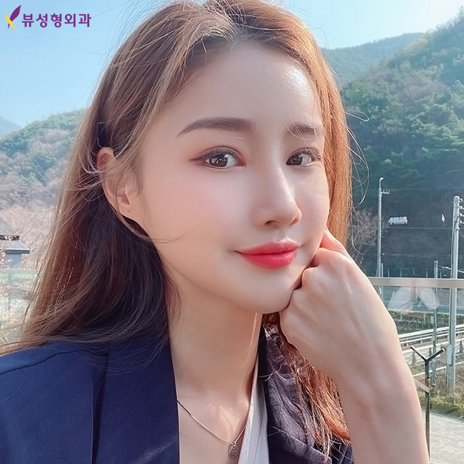 자연스럽게 윤곽잘하는곳 뷰성형외과 관련 이미지 1