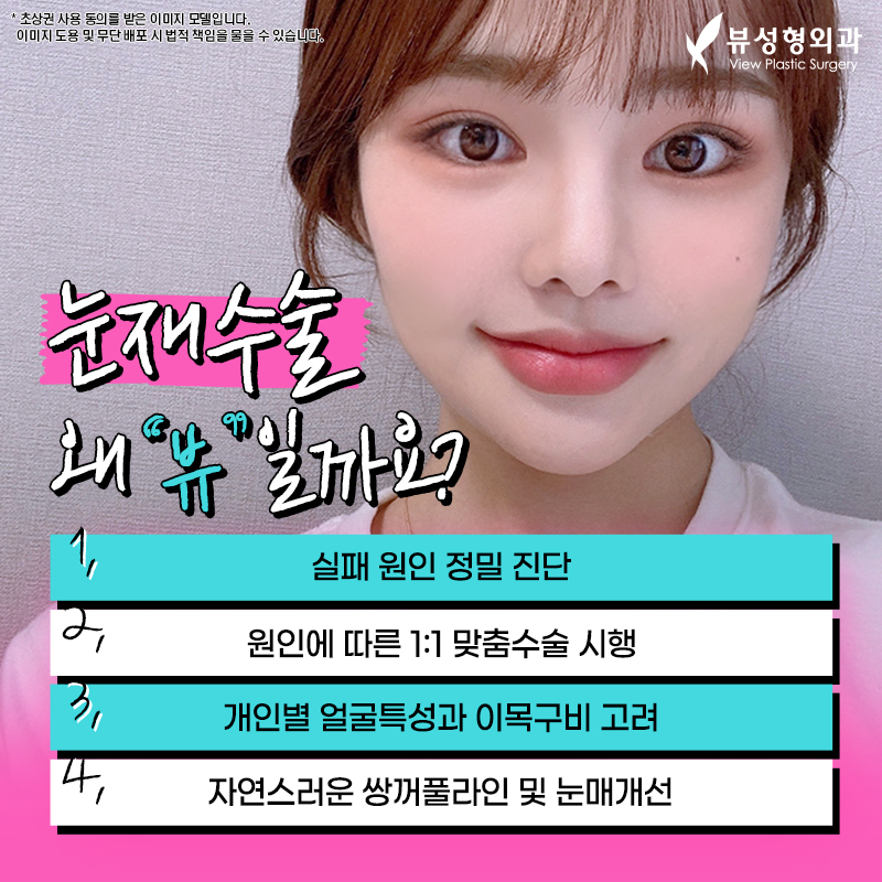 쌍꺼풀재수술비용 높은 난이도이므로 관련 이미지 2