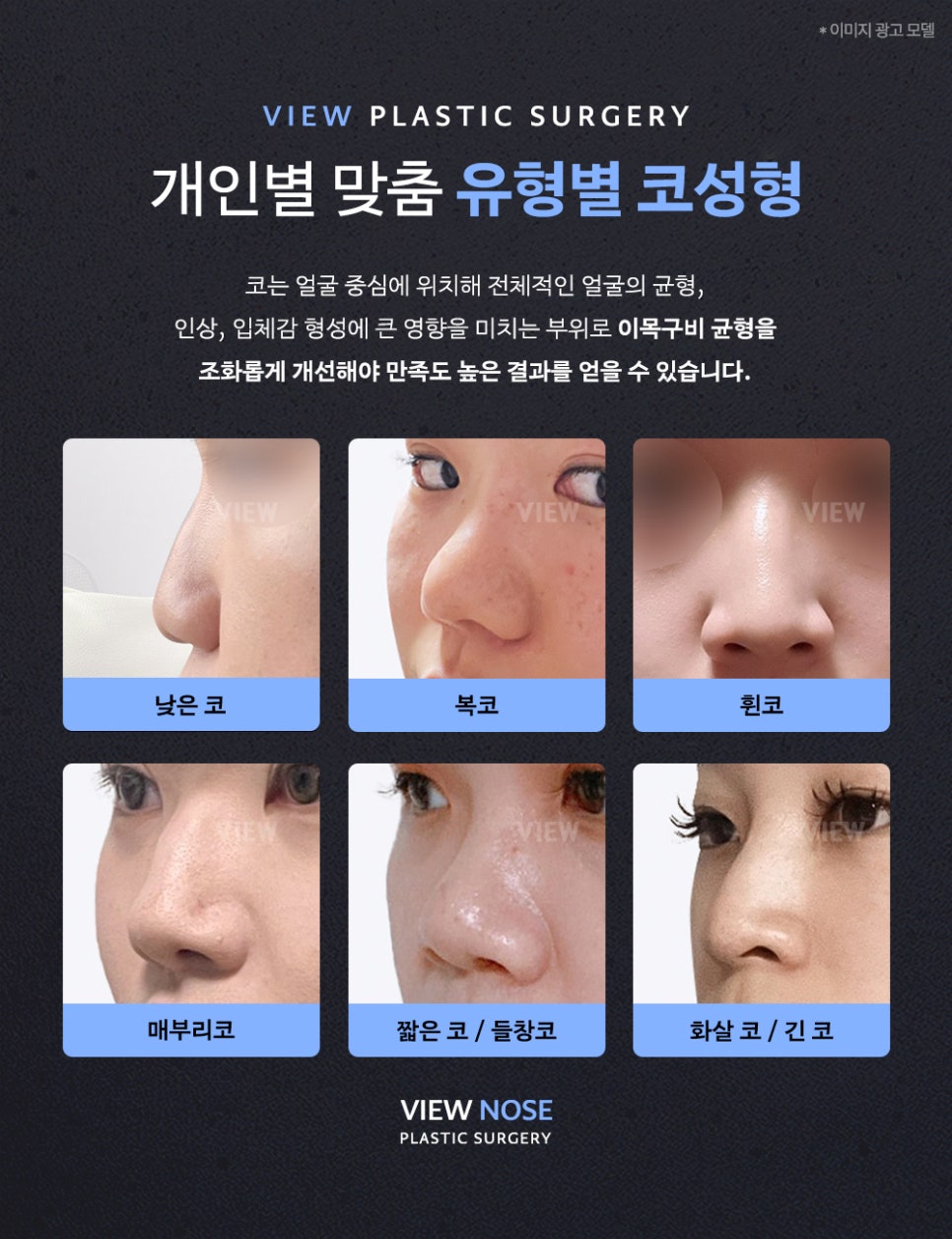 코성형, 개인별 유형에 적합한 수술방법은? 관련 이미지 6