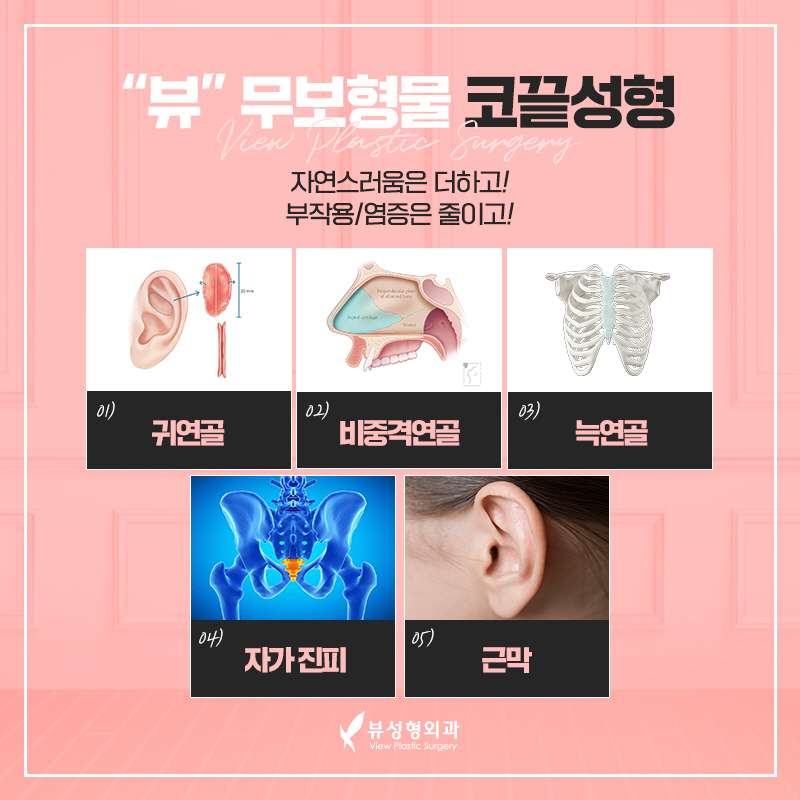 코성형잘하는곳 유형별로 올바르게 관련 이미지 4
