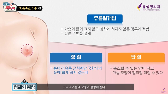 자연스런 가슴성형, 본인에게 적합한 보형물 및 절개방법 선택 중요 관련 이미지 12
