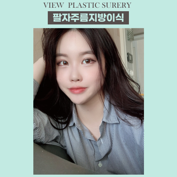 팔자주름지방이식 으로 젊어지자! 관련 이미지 10