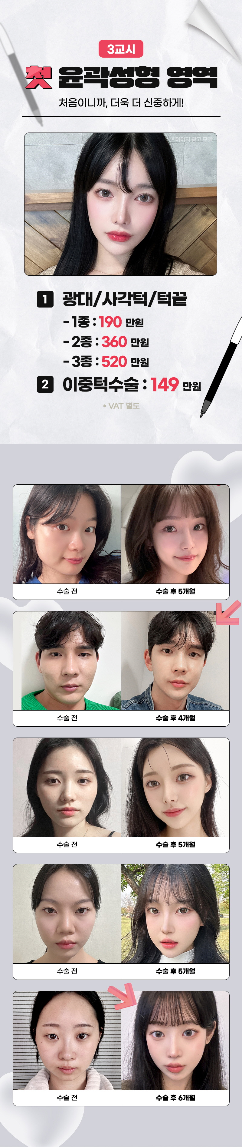 지금이 딱! 뷰성형외과 수능 단독 기획전💜 관련 이미지 5