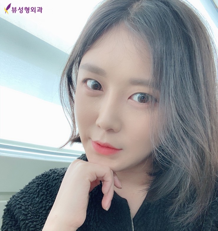 광대축소술 눈치없는 광대 쏙-지워볼까요? 관련 이미지 2