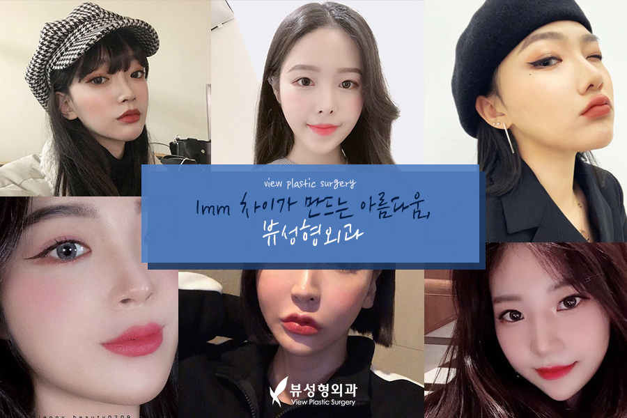 '윤곽3종' 의 뜻 = 인형라인 VS 네추럴라인 비교 관련 이미지 6