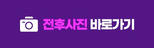 얼굴형의 밸런스를 맞춰주는 안면윤곽수술 관련 이미지 16