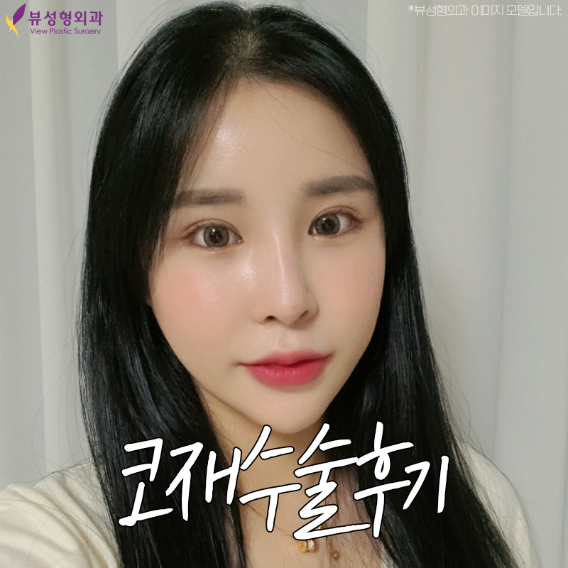 코재수술후기 꼼꼼하게 따져 보아야 할 점은 관련 이미지 9