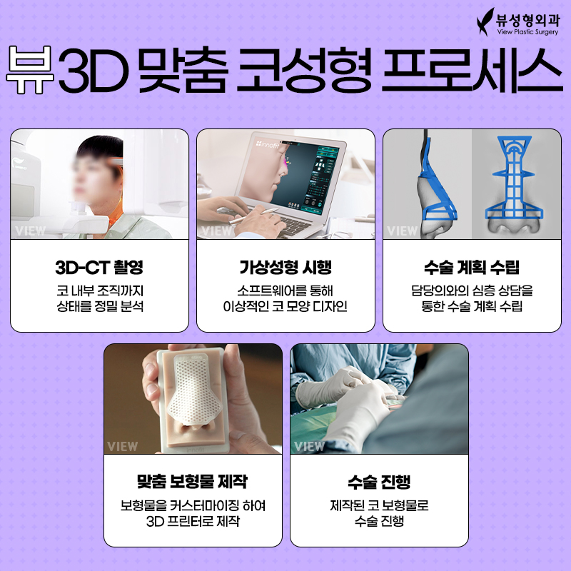 저는 매부리코로 만들어주세요 (?) 관련 이미지 3