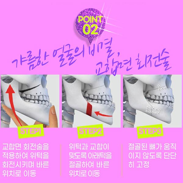 안면비대칭교정방법 자세히 알고 싶다면 관련 이미지 5