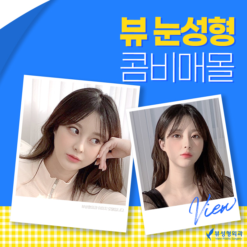 쌍꺼풀매몰법, 뷰에서 빠른 회복까지! 관련 이미지 3