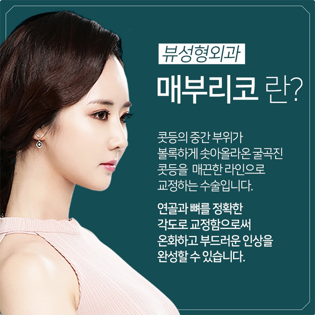 뷰성형외과 매부리코교정, 포인트는? 관련 이미지 3