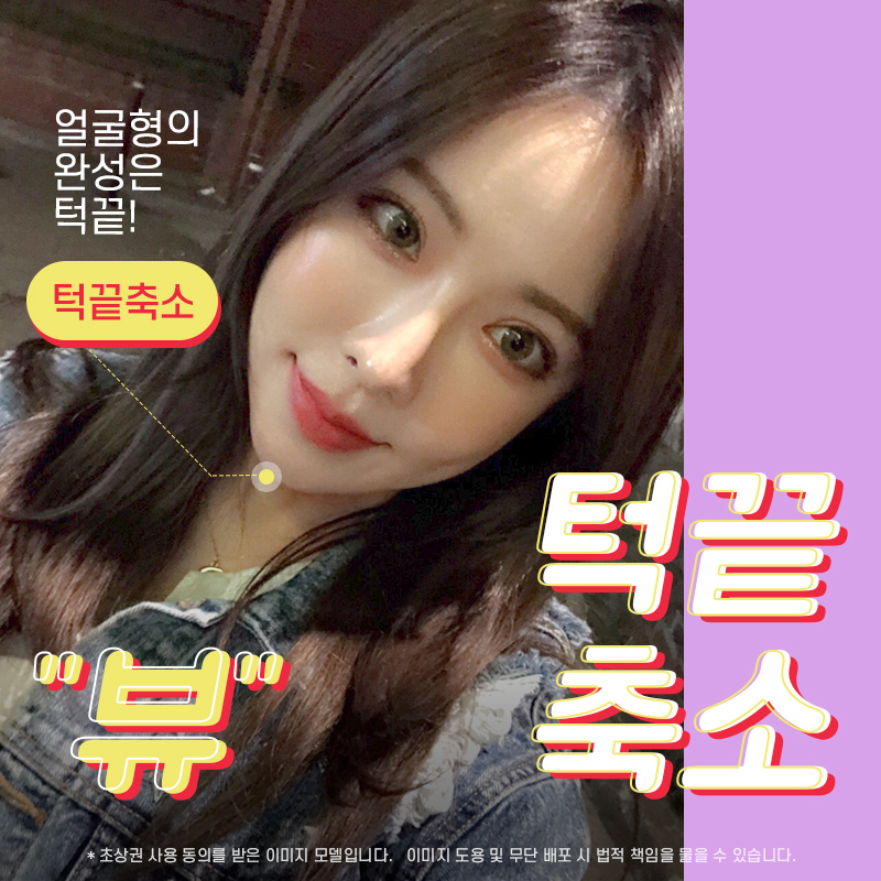 안면윤곽후기 뼈 상태를 위주로 관련 이미지 12