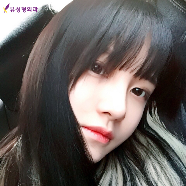 믿고보는 뷰성형외과 코성형후기★ 관련 이미지 4