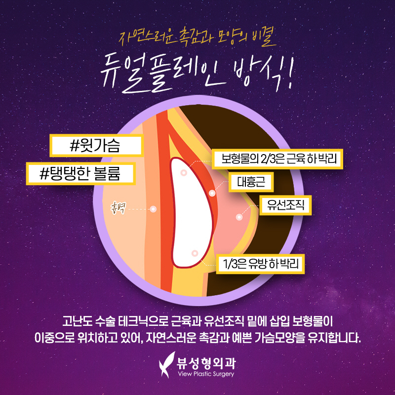 평생 후회없는 “뷰”의 모티바가슴성형💜 관련 이미지 4