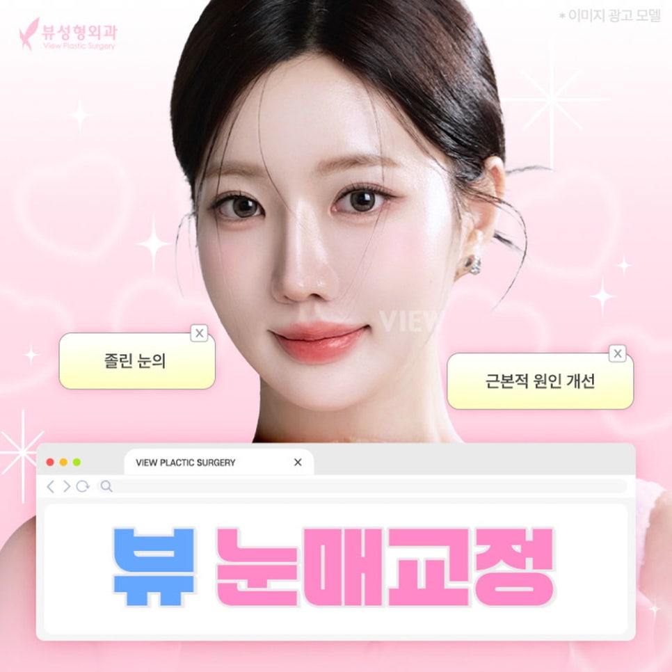 내게 맞는 눈성형 알아보기 관련 이미지 11