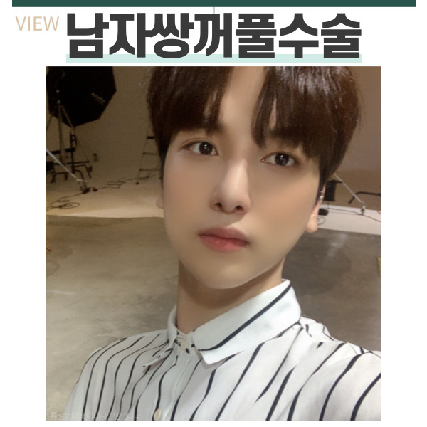 자연스럽고 또렷한 남자쌍꺼풀수술을 원한다면 관련 이미지 7