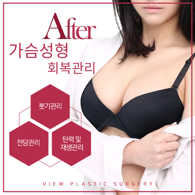 가슴성형수술 남다르게 FLEX 해버렸죠 관련 이미지 4