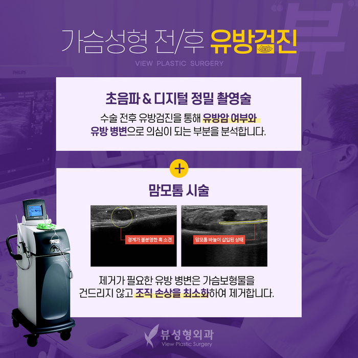 가슴성형 모양과 촉감은 기본, 안전은 필수! 관련 이미지 16