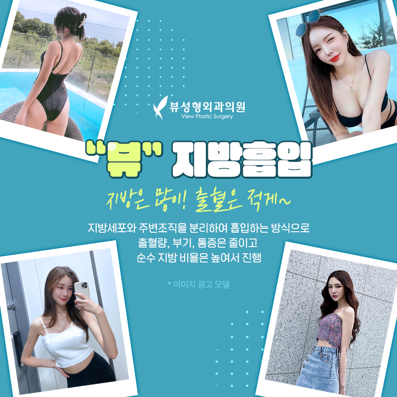 단기간 눈에 띄는 지방 감량 방법, 지방흡입 관련 이미지 3