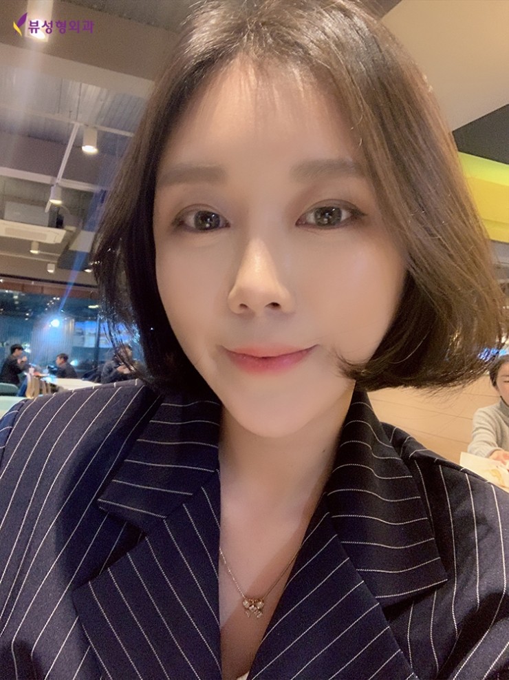 얼굴지방흡입 리프팅으로 V라인 제대로 잡자! 관련 이미지 7