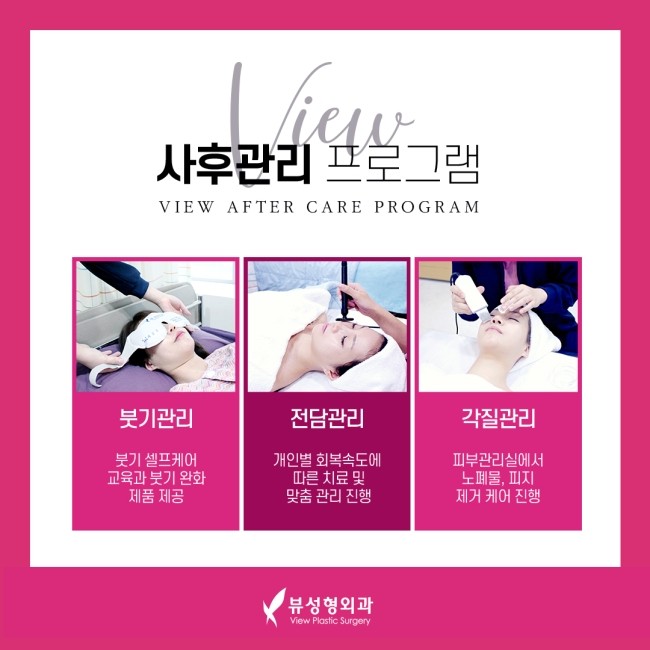 얼굴의 비율과 균형, 조화를 이루는 코성형 관련 이미지 14