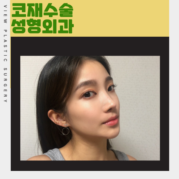코재수술성형외과 찾고있다면 뷰성형외과로 관련 이미지 2