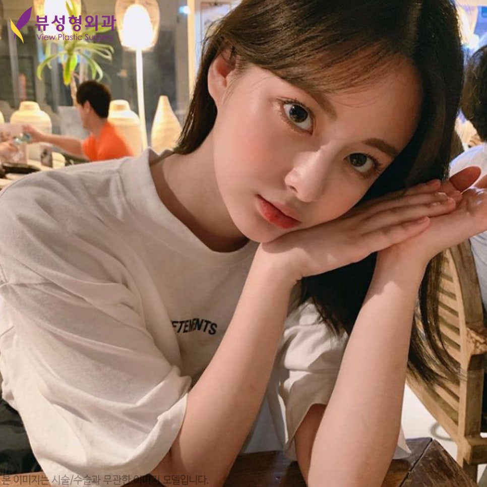 쌍수후기 좋은 눈수술잘하는곳! l 뷰성형외과 관련 이미지 3