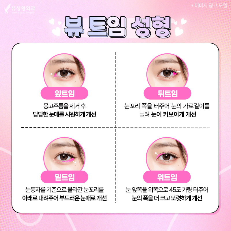 내게 맞는 눈성형 알아보기 관련 이미지 10