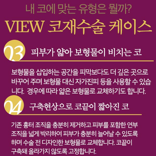 코재수술성형외과 찾고있다면 뷰성형외과로 관련 이미지 8
