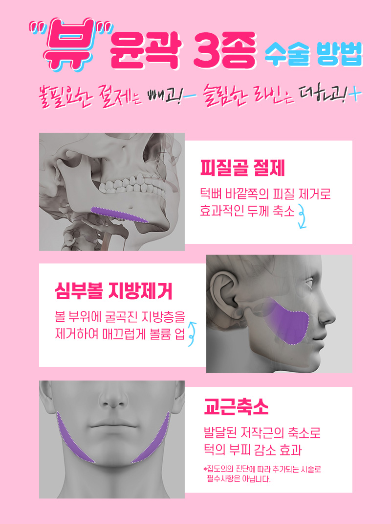 안면윤곽볼처짐, 줄일 수 있는 방법은 관련 이미지 5