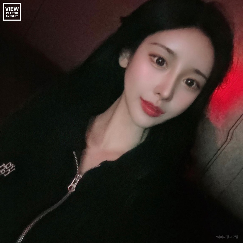 코재수술..보형물은 대체 뭘로 해야 하나요? 관련 이미지 1