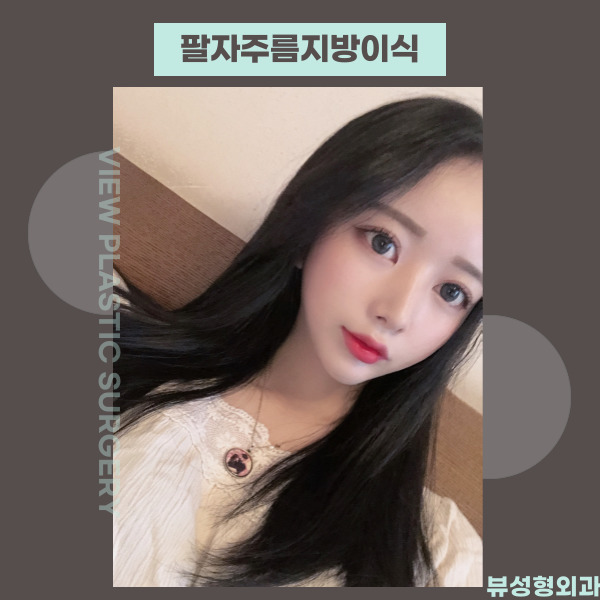 팔자주름지방이식 으로 젊어지자! 관련 이미지 2