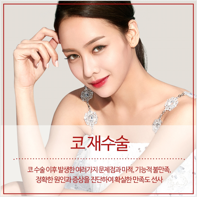 더 이상의 실패 없는, 뷰성형외과 코재수술 관련 이미지 3