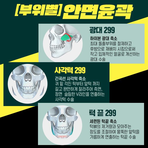 남자안면윤곽수술 의 핵심은! 관련 이미지 6