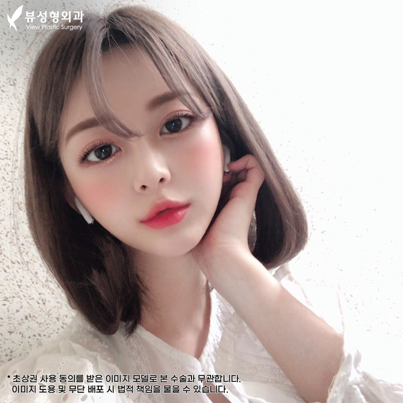 눈재수술유명한곳, 뷰성형외과 관련 이미지 8