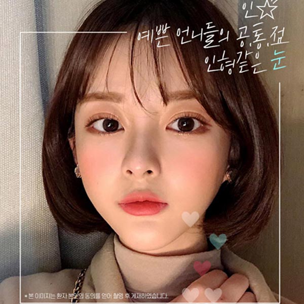쌍꺼풀수술종류 알아보기 관련 이미지 2