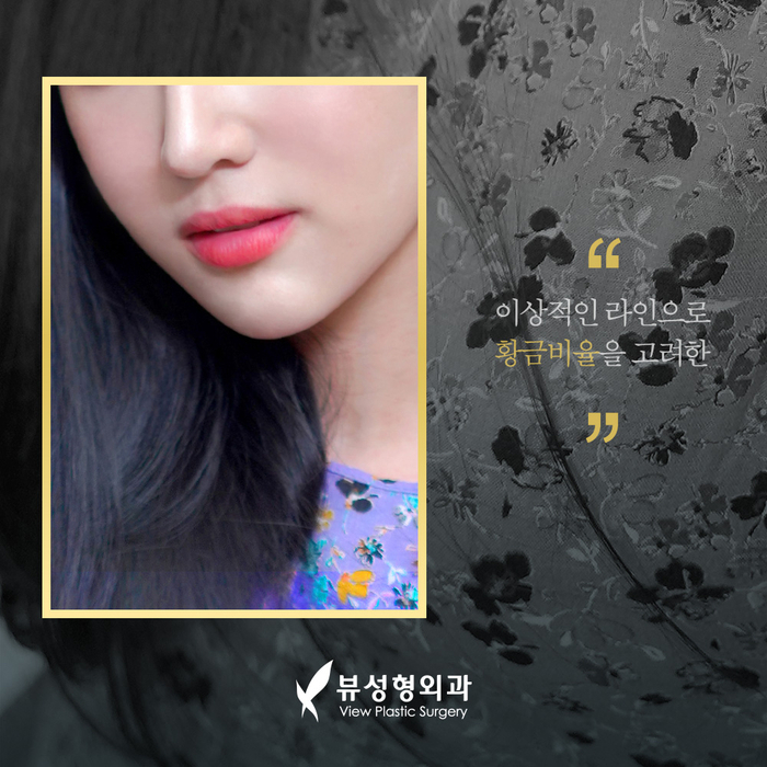 얼굴의 비율과 균형, 조화를 이루는 코성형 관련 이미지 3