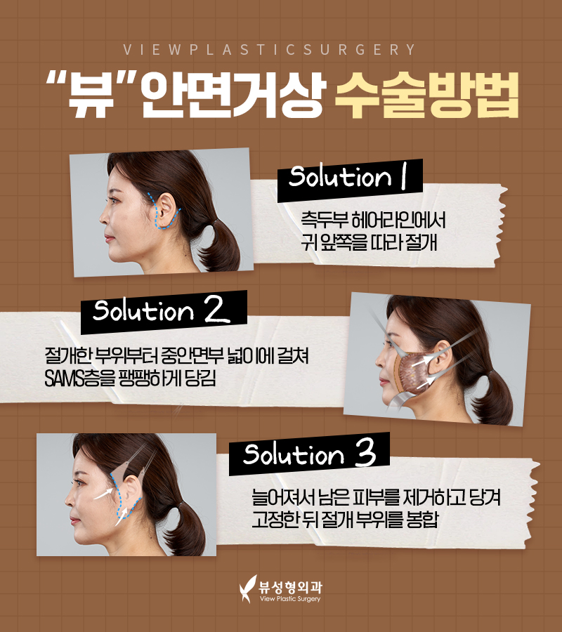 처지고 주름진 피부를 개선하는 다양한 동안성형 방법 관련 이미지 22