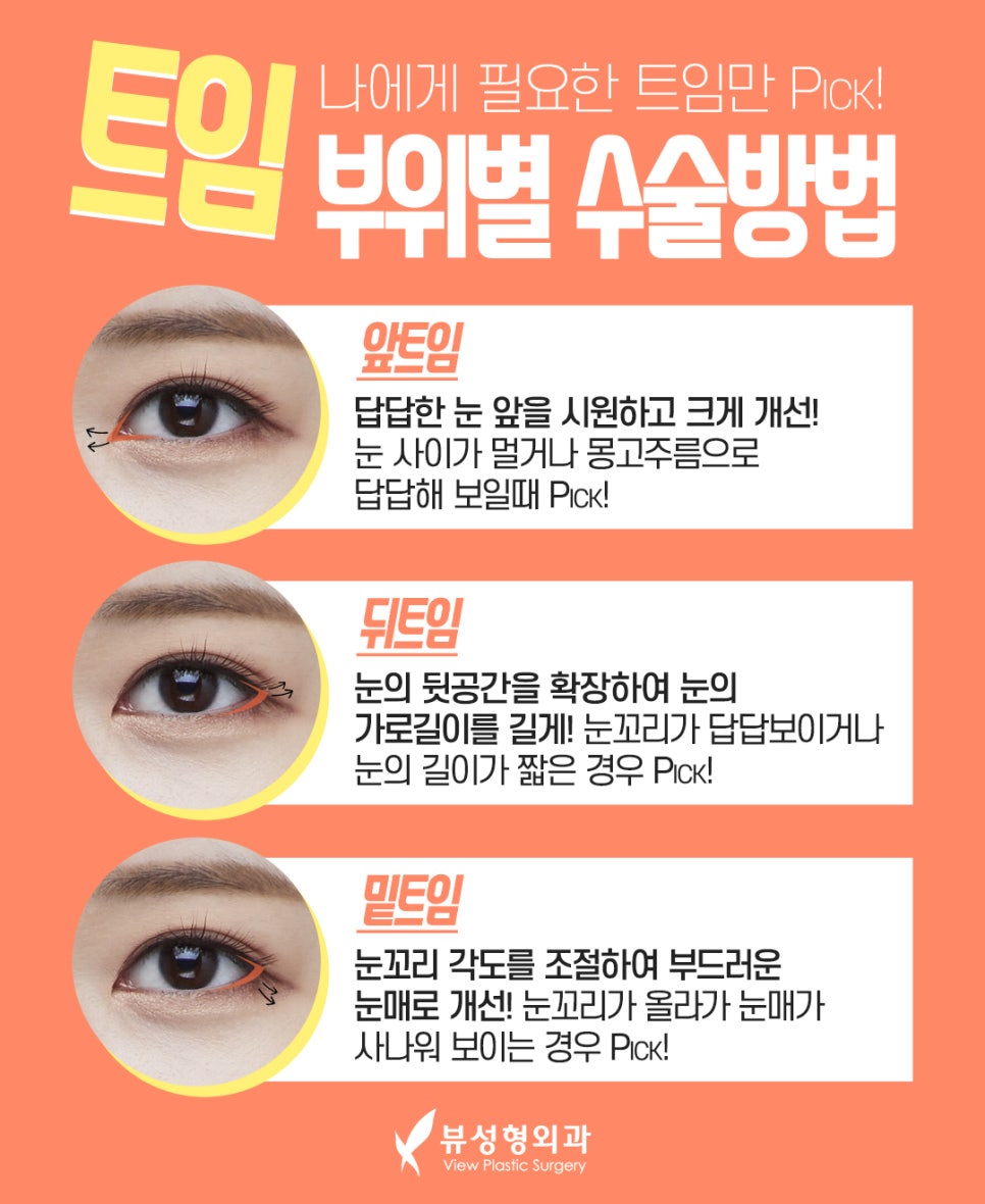 나만의 눈성형을 위한 수술방법 알아보기 관련 이미지 10
