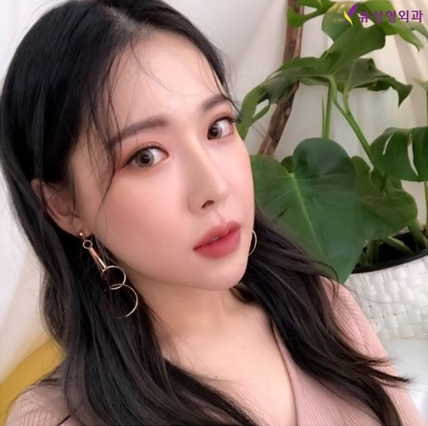 코수술후기 뷰성형외과에서 기대되는 만족감을 관련 이미지 3