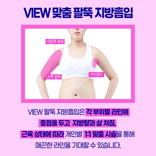 팔뚝살지방흡입 자연스럽고 조화로운 팔뚝을 원한다면 관련 이미지 2