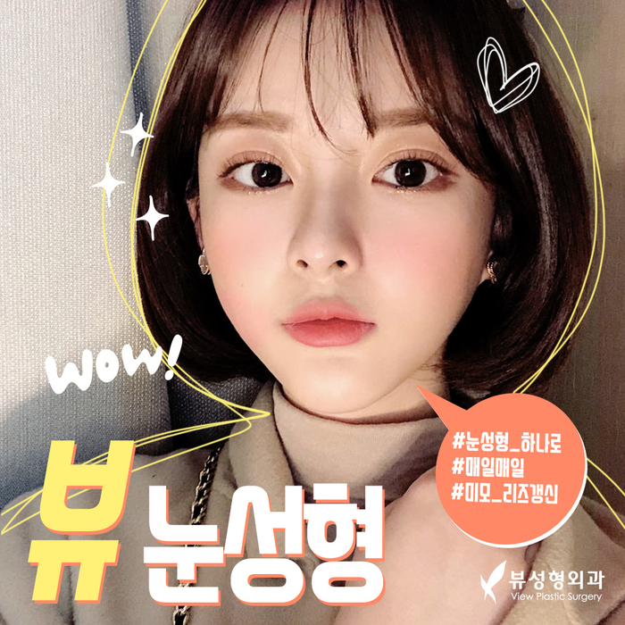 나만의 눈성형을 위한 수술방법 알아보기 관련 이미지 2