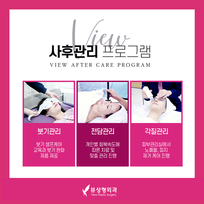 코성형비용 알아봐야 할 부분은? 관련 이미지 9