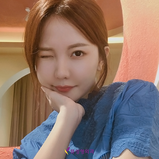 강남트임성형은 뷰성형외과가 찐이다★ 관련 이미지 1