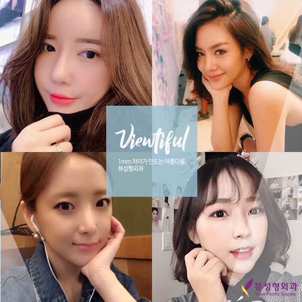 뷰성형외과 4월 이벤트 받고 예뻐지자 관련 이미지 2