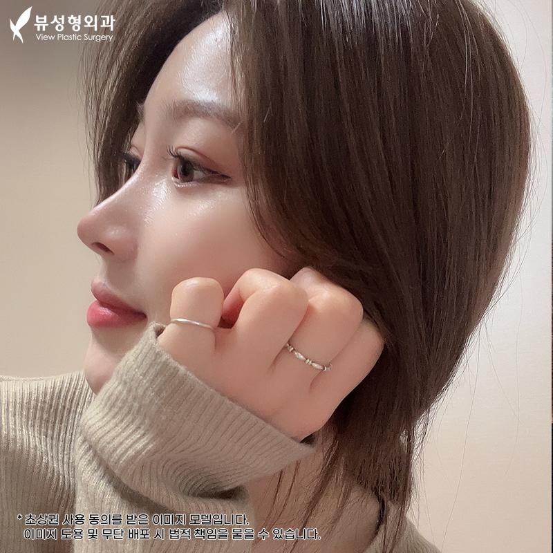 짧은코성형, 뷰에서 뷰티풀하게 관련 이미지 1